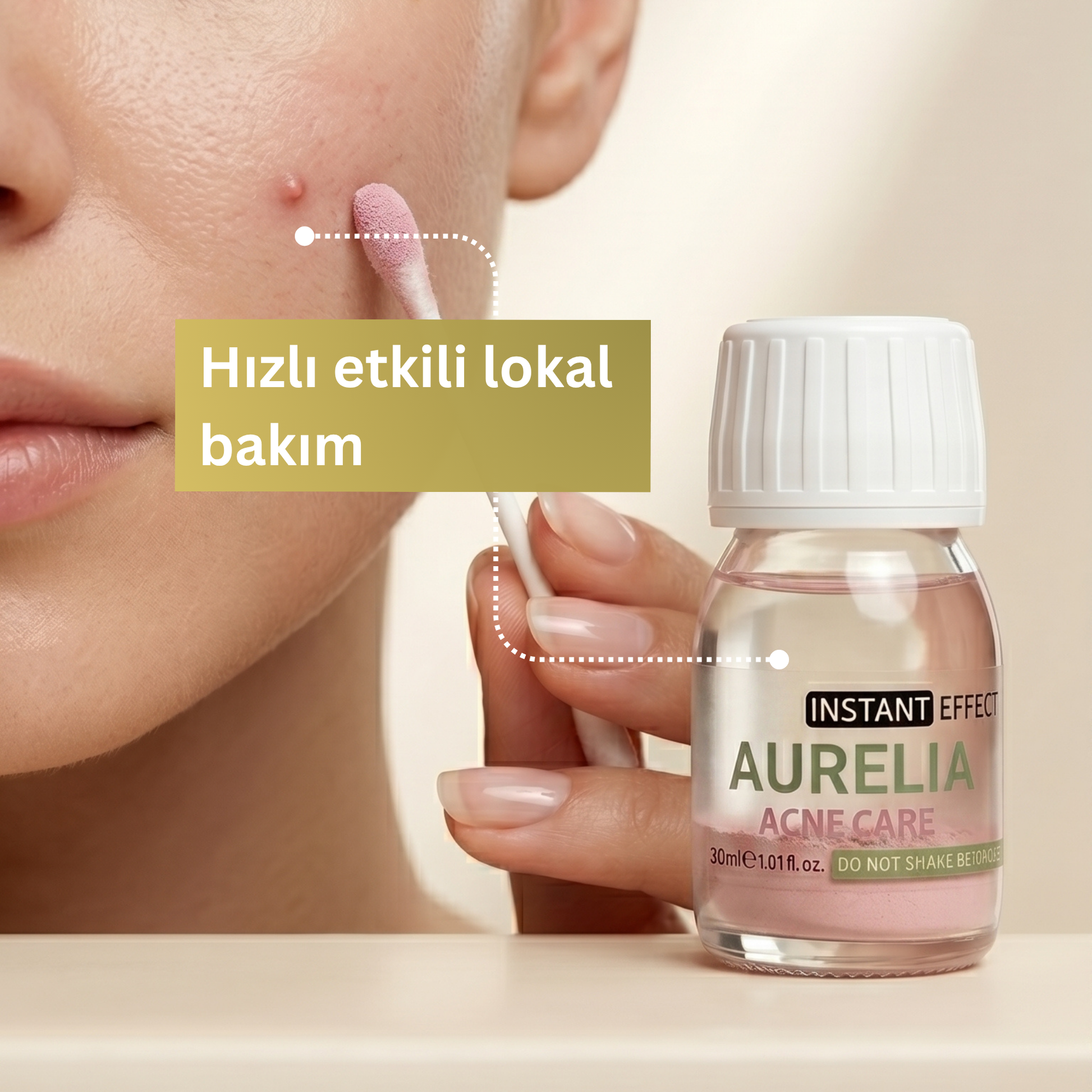 Aurelia – Medical Solution for Acne & Blemishes 30ml