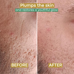 Fascino – Advanced Firming & Skin Perfecting Cream 100ml
